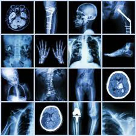 What Are The Main Uses Of X-Rays?